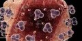 10 باور غلط درباره بیماری ایدز و ویروس HIV