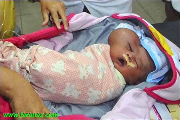 صورت یک نوزاد شبیه به قلب (عکس)