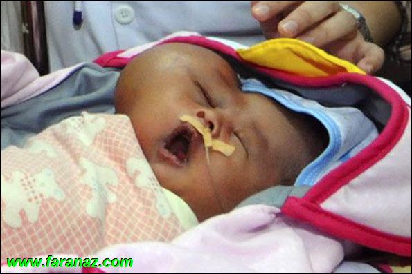 صورت یک نوزاد شبیه به قلب (عکس)