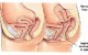 خطرناک ترین عواقب و عوارض نزدیکی از راه مقعد
