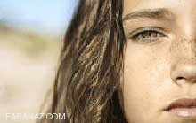 چگونه از کک و مک رهایی یابیم؟ چگونه از کک و مک رهایی یابیم؟
