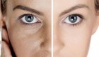 حفره ها و منافذ باز پوست را چگونه برطرف کنیم؟