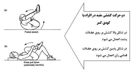 ورزش هایی برای از برطرف کردن گودی کمر
