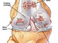 مواد غذایی که محافظ غضروف‌ها است!