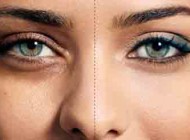 پف و سیاهی زیر چشم ها را چگونه از بین ببریم؟