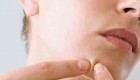 خوراکی هایی که جوش و آکنه را بدتر می کند چیست؟