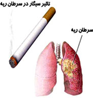 چند پک سیگار برابر است با این‌ همه دردسر!
