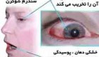 آیا می دانید بیماری «شوگرن» چیست؟