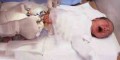 هر آنچه که باید درباره ختنه کردن بدانید