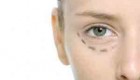 جراحی زیبایی پلک امکان دارد؟