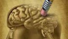 فعالیت ذهنی مانع از زوال عقل می شود
