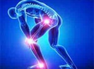 کاهش خطر آرتروز با رعایت این نکات و توصیه ها