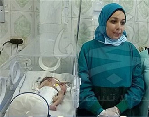 نوزاد بایک سرکامل ویک سرنصفه،2 قلب،3 دست+عکس