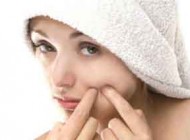 چگونه جای جوش صورت را درمان کنیم؟