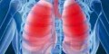 درباره بیماری مزمن انسداد ریه (COPD) بیشتر بدانید؟
