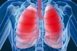 درباره بیماری مزمن انسداد ریه (COPD) بیشتر بدانید؟