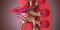 بیماری‌های کلیوی مردم به صورت رایگان تشخیص داده می شود