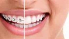 دندان پزشک با متخصص ارتودنسی فرقی دارد؟