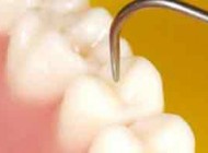 کاشت نگین بر دندان خطرناک است؟