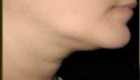 آیا شما هم بادی به غبغبتان افتاده؟