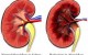 مراقبت از کلیه ها چگونه؟
