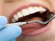 چگونه دندان ها را طبیعی سفید کنیم؟
