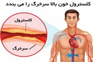 آشنایی با 6 تنظیمکننده خوراکی کلسترول خون آشنایی با 6 تنظیمکننده خوراکی کلسترول خون