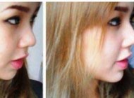 جدید ترین روش برای داشتن بینی زیبا در 20 ثانیه(عکس)