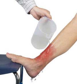 کمکهای اولیه هنگام حوادث در هنگام خانه تکانی