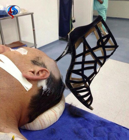 عکس وحشتناک پاشنه کفش زن در سر شوهرش