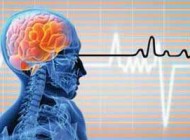 چرا سکته مغزی در ایران رو به افزایش است؟