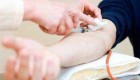 چرا باید فرد ناشتا باشد و آزمایش روی فرد انجام شود؟