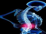 همه چیز درباره گودی کمر و ورزش های درمانی آن