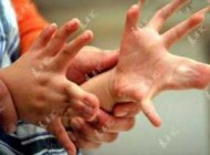 پسر عجیب چینی که جمعا 30 انگشت دارد! (تصاویر)