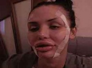 جراحی زیبایی صورت دختر زیبا و جذاب را نابود کرد