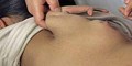 دختر 11 ساله چینی بال دار یکی از عجایب پزشکی! (عکس)