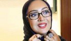 عکس نیکی کریمی با صورت کاملا سوخته