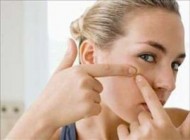 روش های سنتی درمان سریع  انواع جوش
