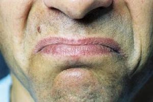 دلیل تلخ شدن دهان و برطرف کردن این مشکل دلیل تلخ شدن دهان و برطرف کردن این مشکل