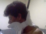 کارگر ایرانی با میله ای در گردن زنده ماند + عکس 18+