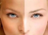 دلایل اصلی تیره شدن پوست و راه درمان تیرگی پوست