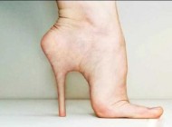 جراحی پلاستیک بلند کردن پاشنه پا دختران و زنان + عکس