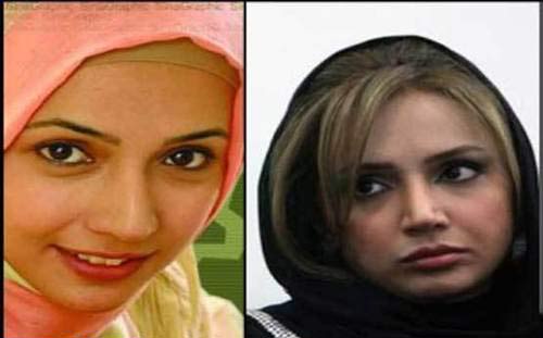 عکسهای جدید لو رفته بازیگران زن ایرانی قبل از عمل زیبایی