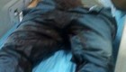 اسید پاشی دختری به آلت جنسی دوست پسرش (عکس18+)