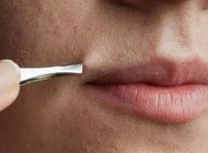 رهایی از شر موهای زیر پوستی به روش خانگی