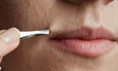 رهایی از شر موهای زیر پوستی به روش خانگی رهایی از شر موهای زیر پوستی به روش خانگی