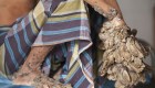 عکس های مردی عجیب با دستان درختی و پاهای سُم مانند