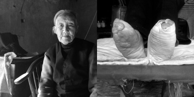 عکسهای وحشتناک از کوچک کردن پای زنان چینی