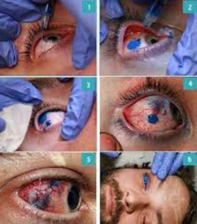 مدل جدید و عجیب تتو کردن سفیدی چشم (عکس)