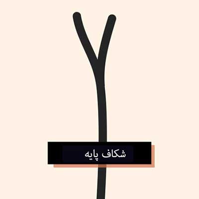تصاویر انواع موخوره و درمان قطعی موخوره